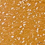 CD56 Antibody in Immunohistochemistry (Paraffin) (IHC (P))