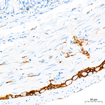 CD56 Antibody in Immunohistochemistry (Paraffin) (IHC (P))
