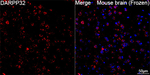 DARPP-32 Antibody in Immunohistochemistry (Frozen) (IHC (F))
