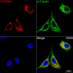 CYP24A1 Recombinant Rabbit Monoclonal Antibody (6X1U2)
