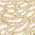 CYP24A1 Antibody in Immunohistochemistry (Paraffin) (IHC (P))