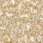 CYP24A1 Antibody in Immunohistochemistry (Paraffin) (IHC (P))