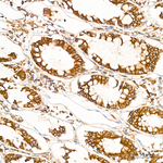 TRAF6 Antibody in Immunohistochemistry (Paraffin) (IHC (P))