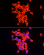 RPGR Recombinant Rabbit Monoclonal Antibody (2I7R3)