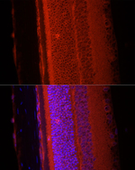 RPGR Antibody in Immunohistochemistry (Paraffin) (IHC (P))