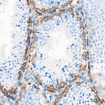 Dicer Antibody in Immunohistochemistry (Paraffin) (IHC (P))