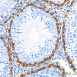 Dicer Antibody in Immunohistochemistry (Paraffin) (IHC (P))