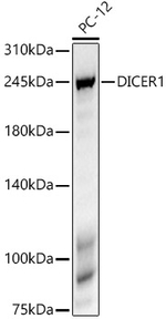 Dicer Antibody in Western Blot (WB)