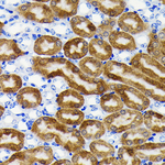 NQO1 Recombinant Rabbit Monoclonal Antibody (1O2N3)