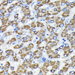 SMAD3 Recombinant Rabbit Monoclonal Antibody (7L6K7)