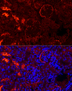 CD10 Antibody in Immunohistochemistry (Paraffin) (IHC (P))