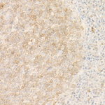 CD10 Antibody in Immunohistochemistry (Paraffin) (IHC (P))