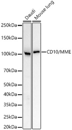 CD10 Antibody in Western Blot (WB)