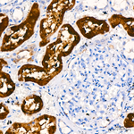 S100A1 Antibody in Immunohistochemistry (Paraffin) (IHC (P))
