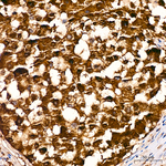 S100A1 Recombinant Rabbit Monoclonal Antibody (10A2K9)