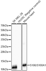 S100A1 Antibody in Western Blot (WB)