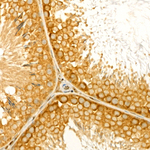BCL-XL Recombinant Rabbit Monoclonal Antibody (2V10G9)