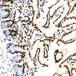 H4K5ac Antibody in Immunohistochemistry (Paraffin) (IHC (P))