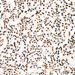 H4K5ac Antibody in Immunohistochemistry (Paraffin) (IHC (P))