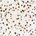 H4K5ac Antibody in Immunohistochemistry (Paraffin) (IHC (P))