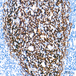 CD21 Recombinant Rabbit Monoclonal Antibody (9F8A1)