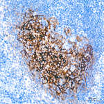 CD21 Antibody in Immunohistochemistry (Paraffin) (IHC (P))