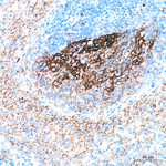CD21 Antibody in Immunohistochemistry (Paraffin) (IHC (P))