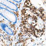 CD45 Antibody in Immunohistochemistry (Paraffin) (IHC (P))