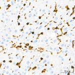 CD45 Antibody in Immunohistochemistry (Paraffin) (IHC (P))