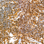 CD45 Antibody in Immunohistochemistry (Paraffin) (IHC (P))