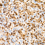 CD45 Antibody in Immunohistochemistry (Paraffin) (IHC (P))
