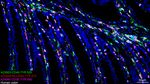 CD45 Antibody in Multiplex Immunohistochemistry (mIHC)