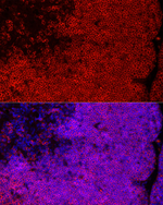 CD8 Antibody in Immunohistochemistry (Paraffin) (IHC (P))