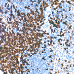 CD8 Antibody in Immunohistochemistry (Paraffin) (IHC (P))