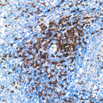 CD8 Antibody in Immunohistochemistry (Paraffin) (IHC (P))