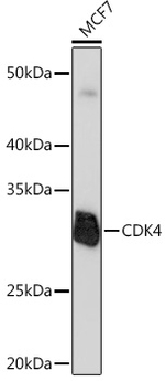 CDK4 Antibody in Western Blot (WB)