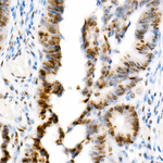 H3K18ac Recombinant Rabbit Monoclonal Antibody (4I3J6)