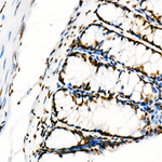 H3K18ac Antibody in Immunohistochemistry (Paraffin) (IHC (P))
