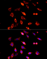 DVL2 Recombinant Rabbit Monoclonal Antibody (2R1Z7)