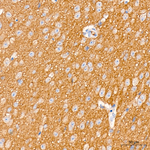 BCL-XL Antibody in Immunohistochemistry (Paraffin) (IHC (P))