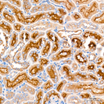 BCL-XL Recombinant Rabbit Monoclonal Antibody (6R4J2)