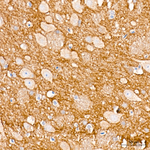 BCL-XL Antibody in Immunohistochemistry (Paraffin) (IHC (P))