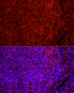 CD79b Antibody in Immunohistochemistry (Paraffin) (IHC (P))