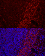 CD79b Antibody in Immunohistochemistry (Paraffin) (IHC (P))