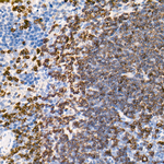 CD79b Recombinant Rabbit Monoclonal Antibody (7P10M4)