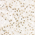 H3K27me3 Antibody in Immunohistochemistry (Paraffin) (IHC (P))