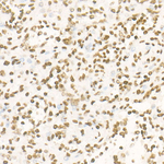 H3K27me3 Antibody in Immunohistochemistry (Paraffin) (IHC (P))