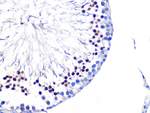 AKT Pan Recombinant Rabbit Monoclonal Antibody (7V9L10)