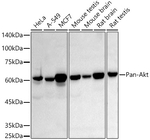 AKT Pan Antibody in Western Blot (WB)