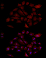 PGP9.5 Antibody in Immunocytochemistry (ICC/IF)